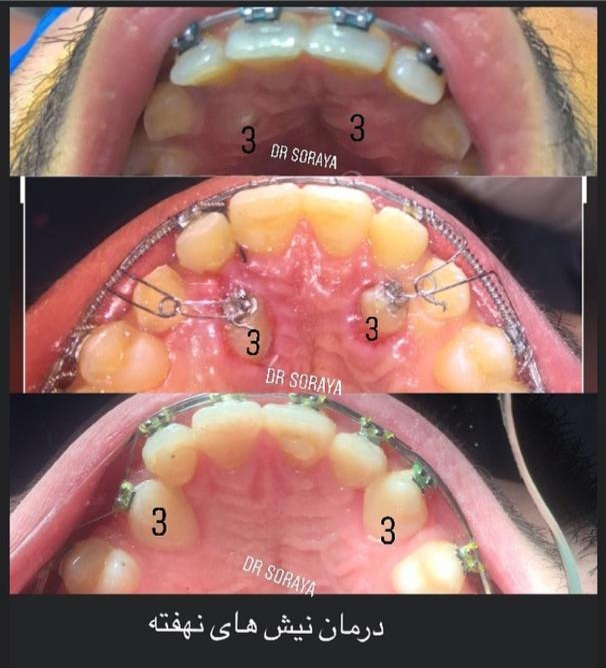 جراحی دندان در بابل دکتر ثریا یوسف نژاد