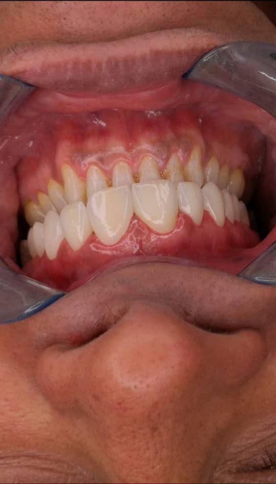 زیبایی دندان در قم