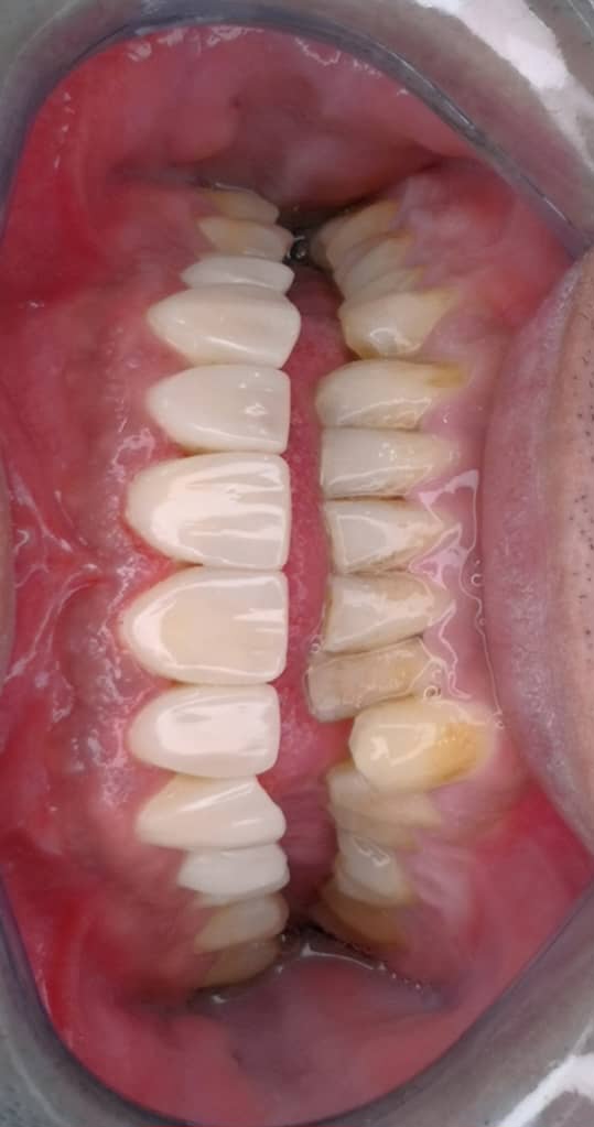 جراحی دندان در قم